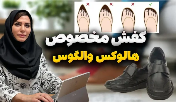 تاثیر کفش بر هالوکس والگوس