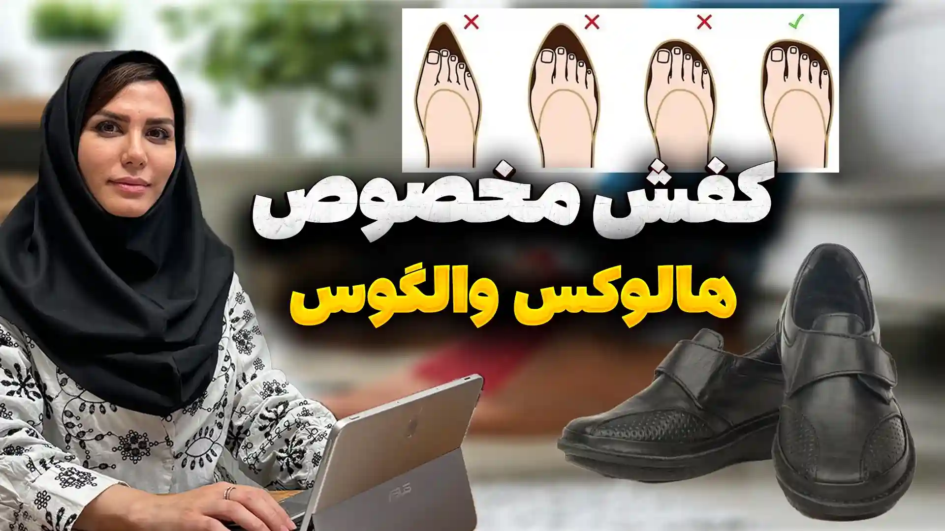 تاثیر کفش بر هالوکس والگوس